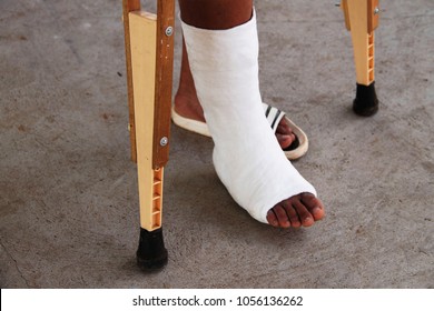 Close-up Photos Of Foot Splint For Treatment Of Injuries From Broken Bones.