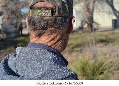 Close-up Picture Of A Man With Leathery Skin In Camo Hat.