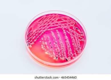 78 Xylose test Images, Stock Photos & Vectors | Shutterstock