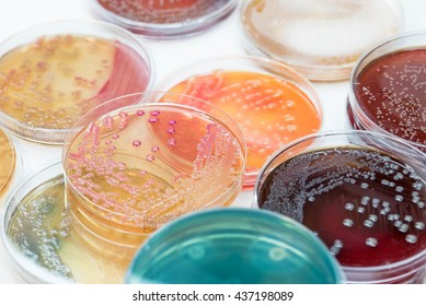 Closeup For Plate Bacteria Culture Growth On Selective Media In Microbiology Room At Laboratory In The Hospital.
