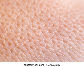 Closeup of porous oily human skin. Large pores on the skin, background, macro, cosmetology