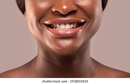 African White Teeth Smile High Res Stock Images Shutterstock