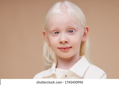 close-up portrait of little caucasian girl with albinism syndrome. abnormal deviations. unusual appearance. skin abnormality