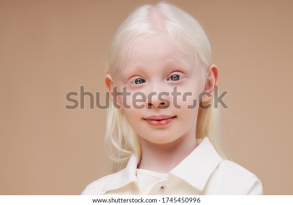 Closeup Portrait Little Caucasian Girl Albinism 库存照片（立即编辑）1745450996