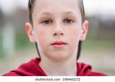 Close-up Portrait Of Teenage Serious Boy With Freckles On His Face, Shallow Depth Of Field