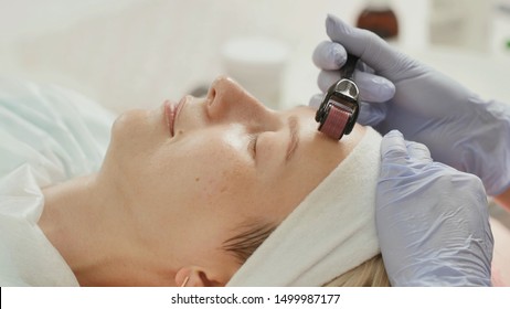 Close-up Portrait Of Woman Having Beauty Skin Treatment. Therapist Preparing Skin With Derma Roller.