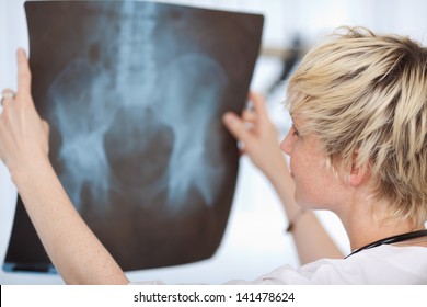 Closeup Portrait Of Young Female Doctor Looking At Hip Xray Report In Hospital