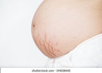 Closeup of a pregnant belly with stretch marks. Isolated on white