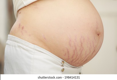 Closeup of a pregnant belly with stretch marks. Isolated on white