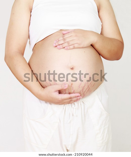 Closeup Pregnant Belly Stretch Marks Isolated Stock Photo 210920044   Closeup Pregnant Belly Stretch Marks 600w 210920044 