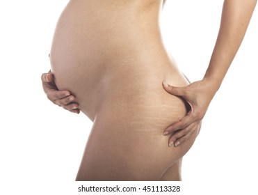 Closeup of a pregnant woman with stretch marks on the buttocks. Isolated on white