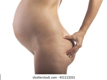 Closeup of a pregnant woman with stretch marks on the buttocks. Isolated on white