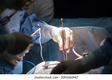 Closeup Of Professional Doctor Hands Operating A Patient During Open Heart Surgery In Surgical Room. Healthcare And Medical Intervention Concept