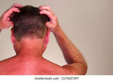 Close-up rear view of a shirtless adult caucasian man massaging with his hands his head that has brown hair. Upper body rear view of a mature white male massaging his scalp with his hands and fingers