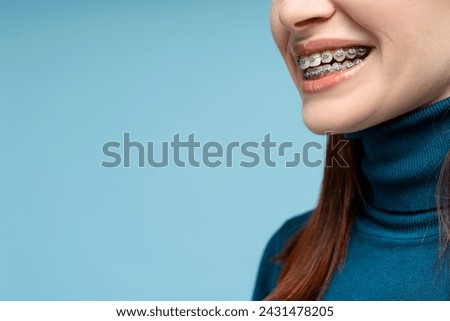 Closeup of a red haired woman with a beautiful smile and dental braces, wearing a polo neck sweater, isolated on a blue background. Focus on dental wellness