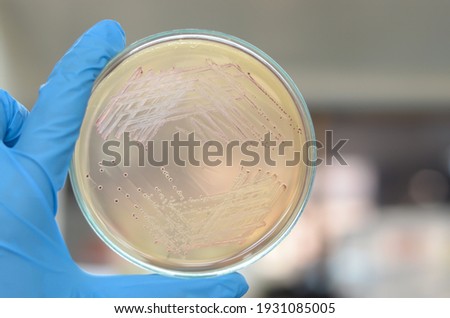 Close-up of reddish-brown Enterococci faecium(Top) and  Enterococcus faecalis(Bottom) bacterial colonies growth on Slanetz-Bartley (Enterococci Agar) plate with scientist hand holding