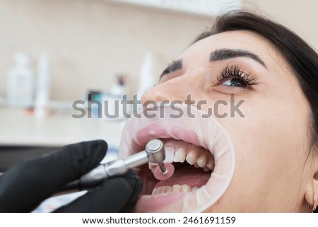 Close-up, restoration of teeth, application of veneers