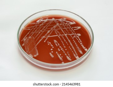 Close-up of Rhodococcus equi bacterial colonies growth on blood agar plate with white background