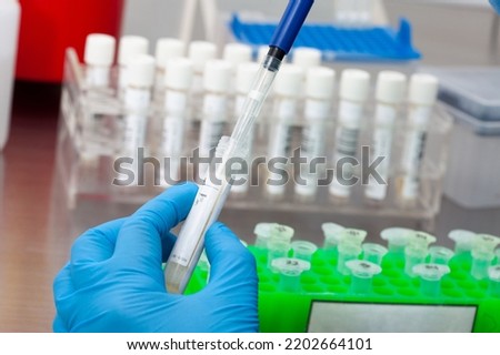 Closeup of a scientist extracting DNA using the spin column-based nucleic acid purification technique. Spin column-based nucleic acid purification technique. Diagnosis of human papillomavirus virus.

