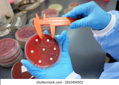 Close-up of Scientist hands using a caliper measure zones of inhibition (clear zone) while during disk diffusion method  on Mueller-Hinton-blood agar plate