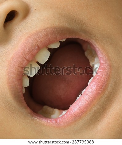 Similar – gap between one’s teeth