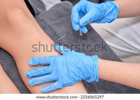 Close-up of shirtless man receiving dry needling therapy from physician in clinic Close-up of physiotherapist performing dry needling treatment on leg. Injury recovery procedure 