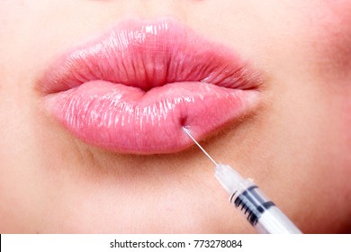 Closeup shot of beautiful young woman receiving filler injection in lips, beauty treatment concept
