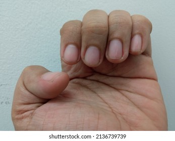 Closeup Shot Of Brown Asian Hand Showing Nails