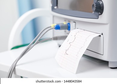 Close-up shot of Cardiotocograph machine or Electronic Fetal Monitor (EFM) recording the fetal heartbeat and the uterine contractions during pregnancy. Cardiotocography (CTG) monitoring concept