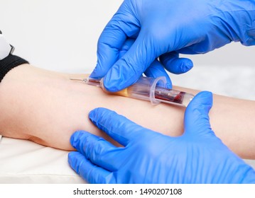 Close-up shot of doctor or nurse taking a blood sample from arm vein with a vacutainer. Venipuncture or venepuncture procedure