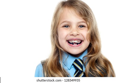 Closeup Shot Of A Happy School Kid Flashing Toothy Smile Wearing Braces.