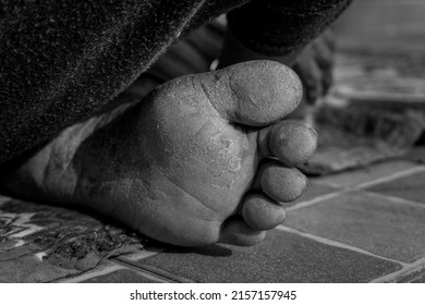 A closeup shot of rough feet of an elderly woman in India in black and white.