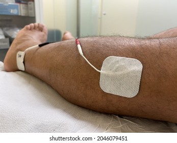 A close-up shot of two electrodes placed on the man's leg to relieve overactive bladder symptoms
