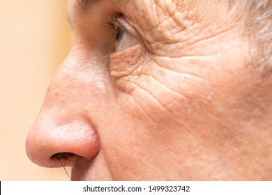 A Closeup And Side Profile View On The Face Of A Fifty Year Old Man, Mature Aging Is Seen With Heavy Wrinkles, Crow's Feet And Nasal Hair.