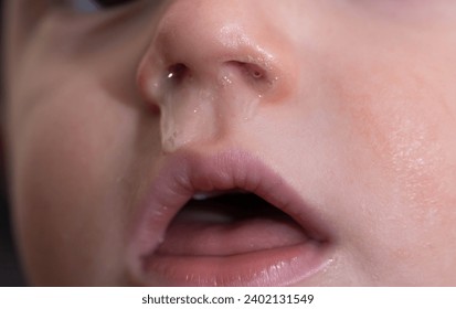 Close-up of a small child's face and nose with snot. The concept of colds, rhinitis and runny nose in children, allergy