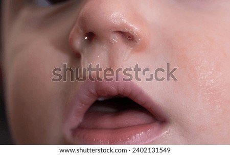 Close-up of a small child's face and nose with snot. The concept of colds, rhinitis and runny nose in children, allergy