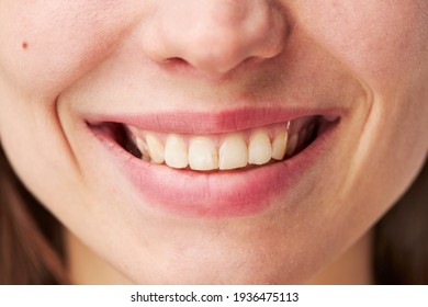 closeup of smile girl with white healthy teeth