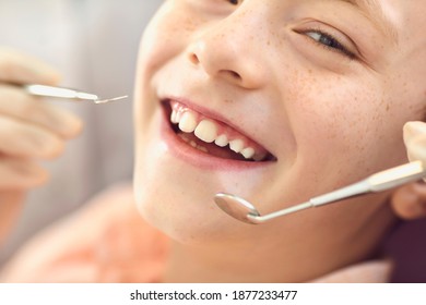 Close-up Smiling Child Boy Check-up In Dentist Office. Caries Prevention And Dental Treatment. Healthy Teeth And Smile. Dentistry. Children's Doctor Orthodontist. Dentist Appointment. Orthodontics.