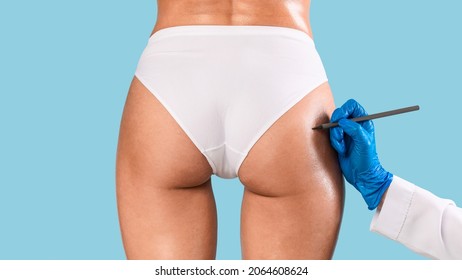 Closeup of surgeon drawing marks on female buttocks, preparing for cosmetic operation isolated on blue studio background. Woman getting ready for aestetic procedure, gluteal lipolysis, rear back biew