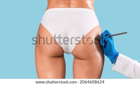 Closeup of surgeon drawing marks on female buttocks, preparing for cosmetic operation isolated on blue studio background. Woman getting ready for aestetic procedure, gluteal lipolysis, rear back biew