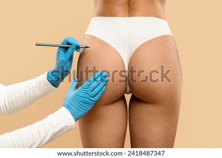 Closeup of surgeon drawing marks on female buttocks, preparing for lipolysis operation isolated on beige studio background. Woman getting ready for aesthetic procedure, rear view, cropped