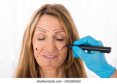 Close-up Of Surgeon Hands Drawing Correction Lines On Woman Face With Marker - Powered by Shutterstock