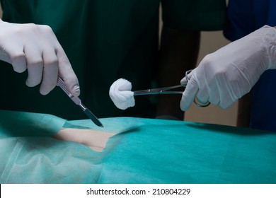 Closeup Of Surgeon Making Surgery Of Abdomen