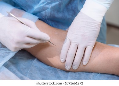 Closeup Surgeon Performs Operation On Patients Stock Photo 1091661272 ...