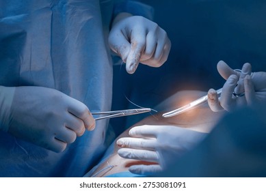 Close-up of surgeons performing precise operation in sterile environment, sunlight.