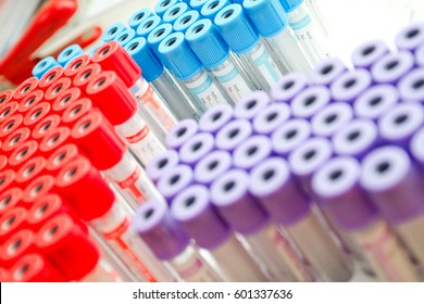 Close-up of test tubes arranged on a tray in medical laboratory. Medical healthcare analysis in a hospital. Biology analysis for immunity viruses.