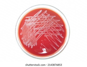 Close-up of Trueperella pyogenes  bacterial colonies growth on blood agar plate with white background from top view