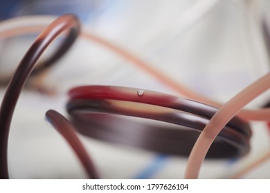 Close-up Of Tubes With Blood It's Blood Transfusion At The Hospital