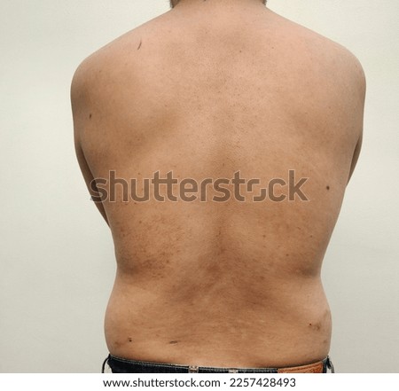 Close-up veiw of Asian man's waist back wearing white shirt. There is a lot of excess fat. See the fat groove that was born and concepts of diet, exercise, lose weight, increase fitness and firmness