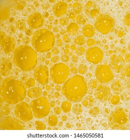 Closeup View Of Bubbles In Frothy Urine. Urine Sample For Urine Culture Test Or Examination.